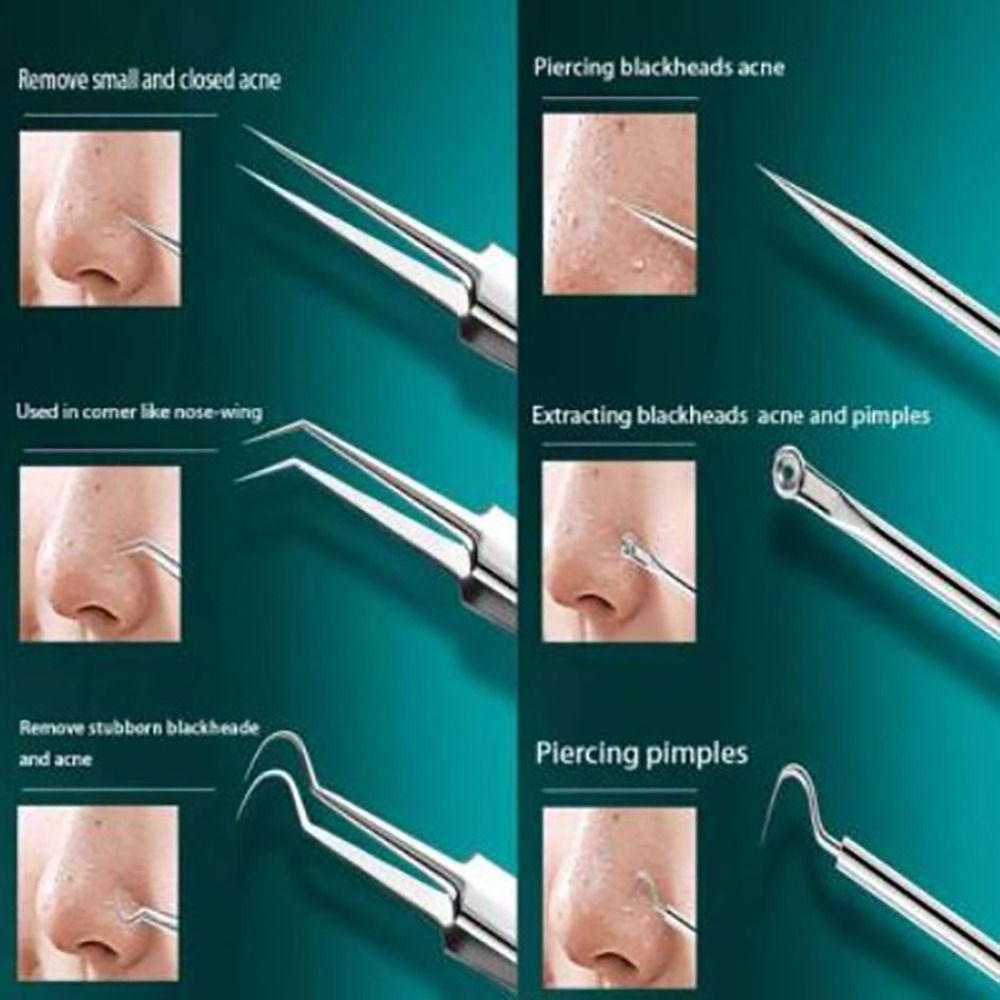 8pcs Ultra - fine Beauty Salon Acne Needle Tool Set - New Beginnings